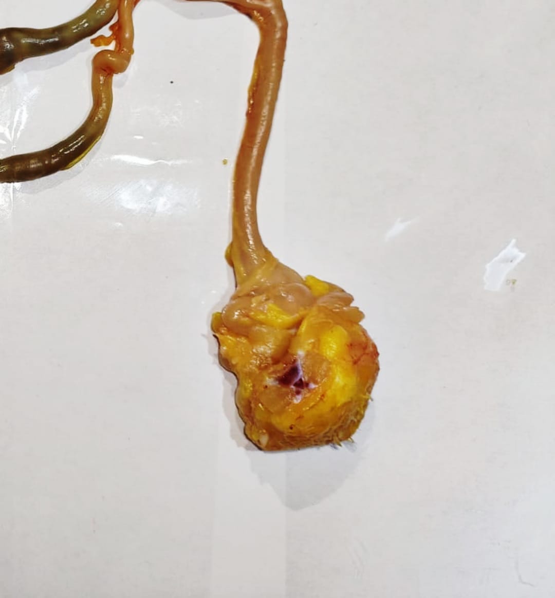 Figura 11. Cloaca del pollo. Elaboración propia.